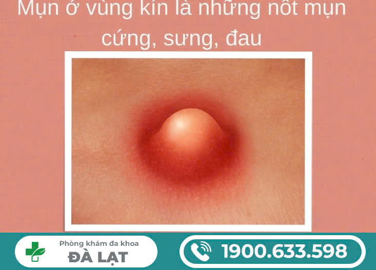 Hình ảnh minh họa